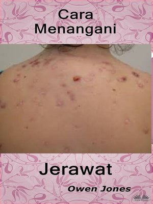 cover image of Cara Menangani Jerawat